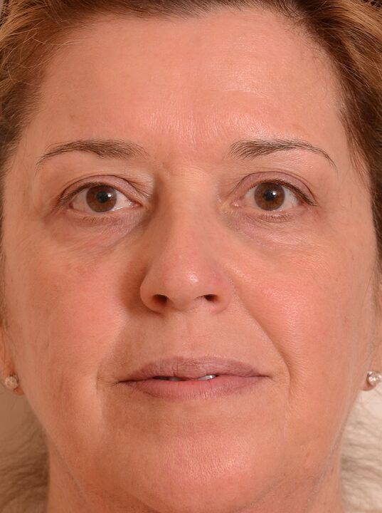 Mi -am întinerit fața cu crema Eudalie